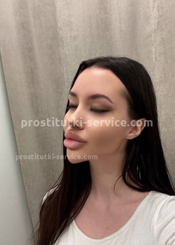 Лисса, Г. Глазов